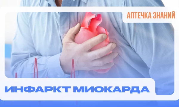 АПТЕЧКА ЗНАНИЙ: Лилия Санджиева об инфаркте миокарда